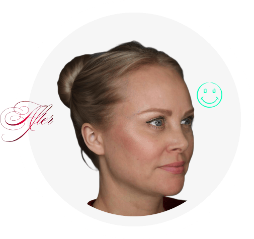 after Double breasted