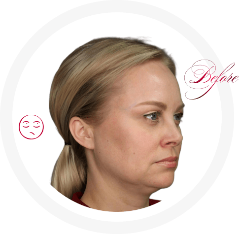 before Double breasted