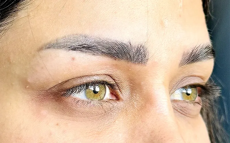 تصویر قبل از کلینیک تخصصی کاشت ابرو در شیراز  | خواب طبیعی و تراکم حداکثری