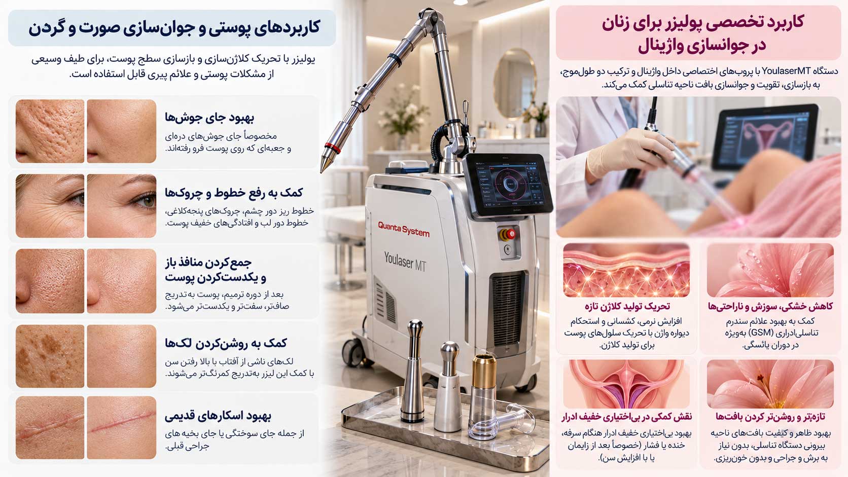 کاربردهای درمانی یولیزر کوانتا سیستم در شیراز