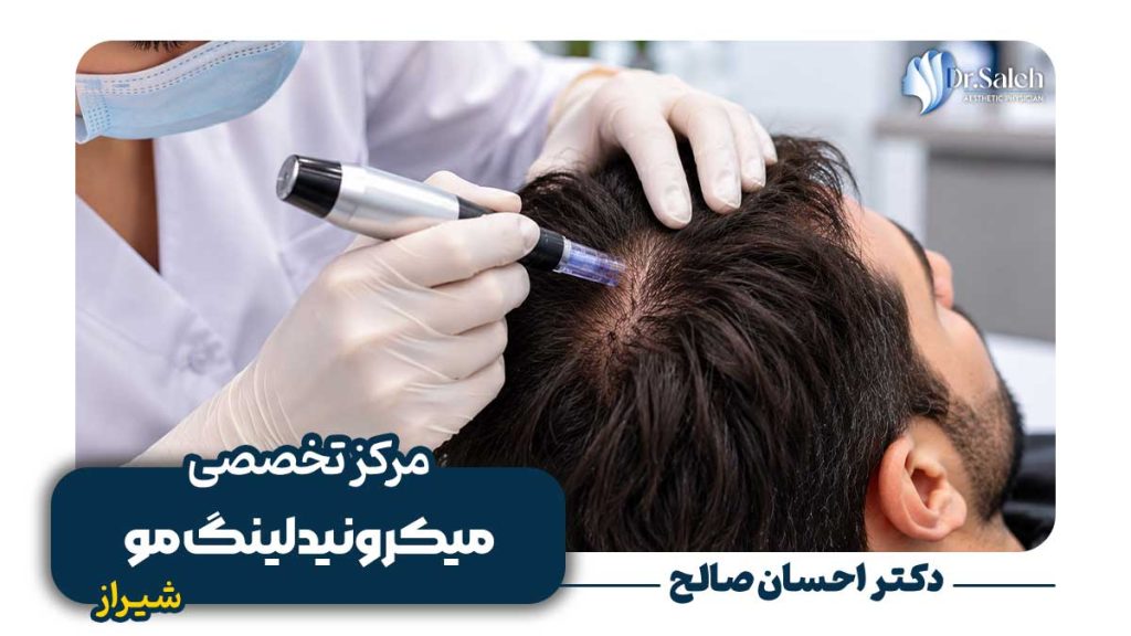میکرونیدلینگ مو در شیراز