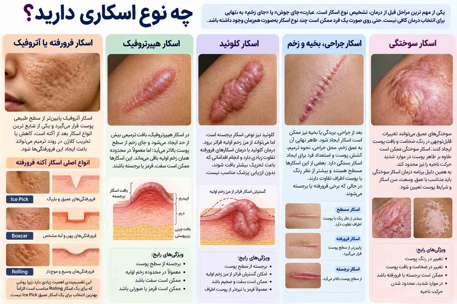 چه نوع اسکاری دارید؟ روش های درمان انواع اسکار در کلینیک دکتر صالح شیراز